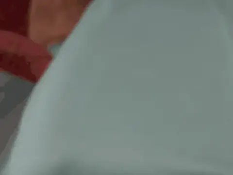 32 Straight Gliding Distracted
